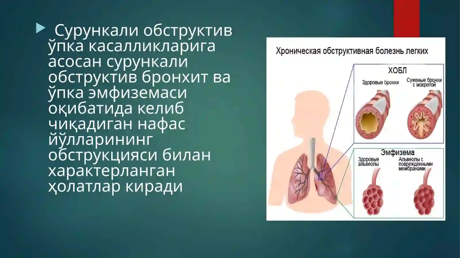 O'pkaning surunkali obstruktiv kasalliklari 2