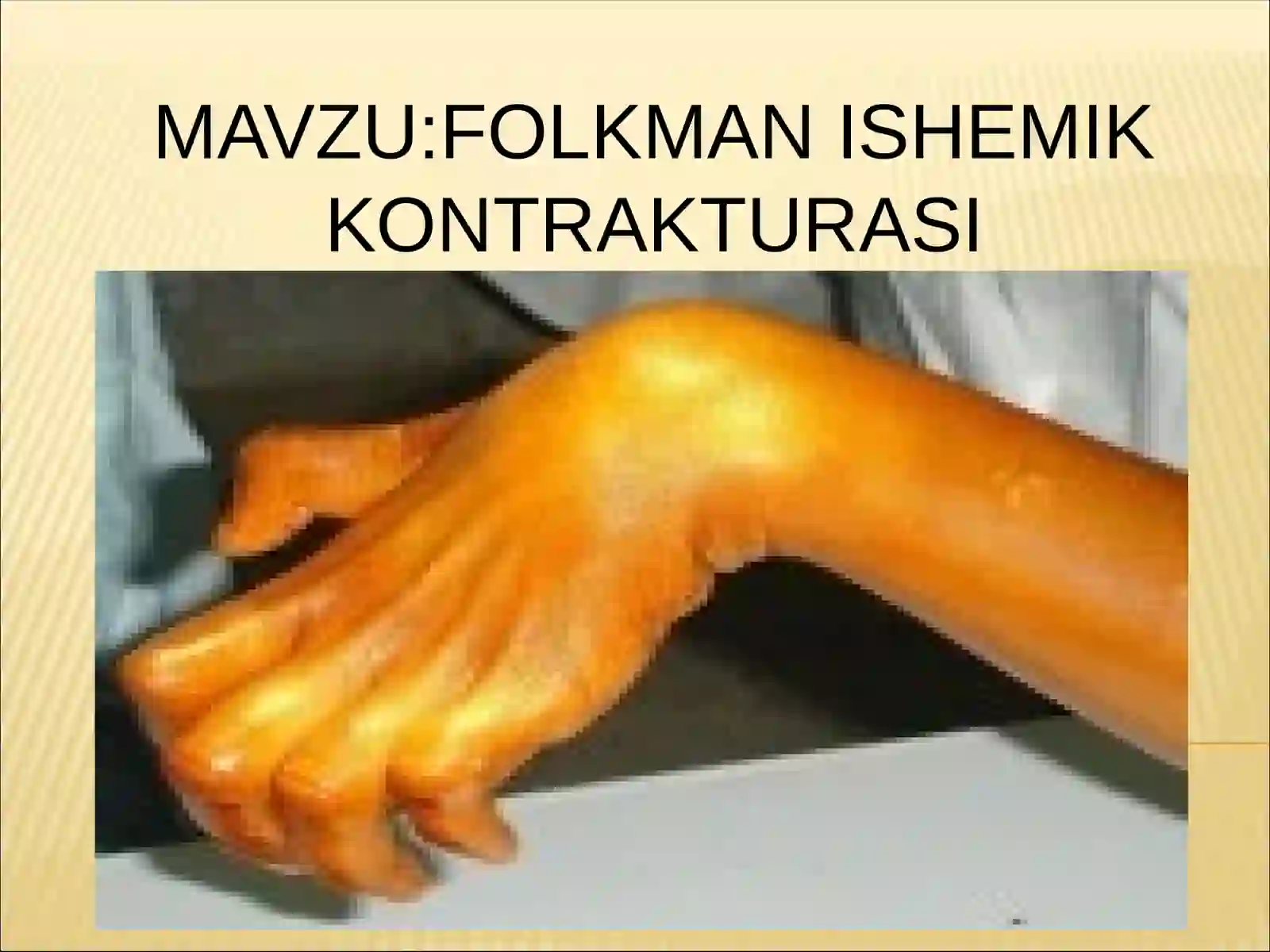 FOLKMAN ISHEMIK KONTRAKTURASI 2
