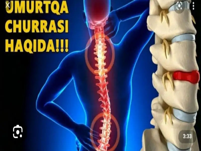 Umurtga disk churrasi 2