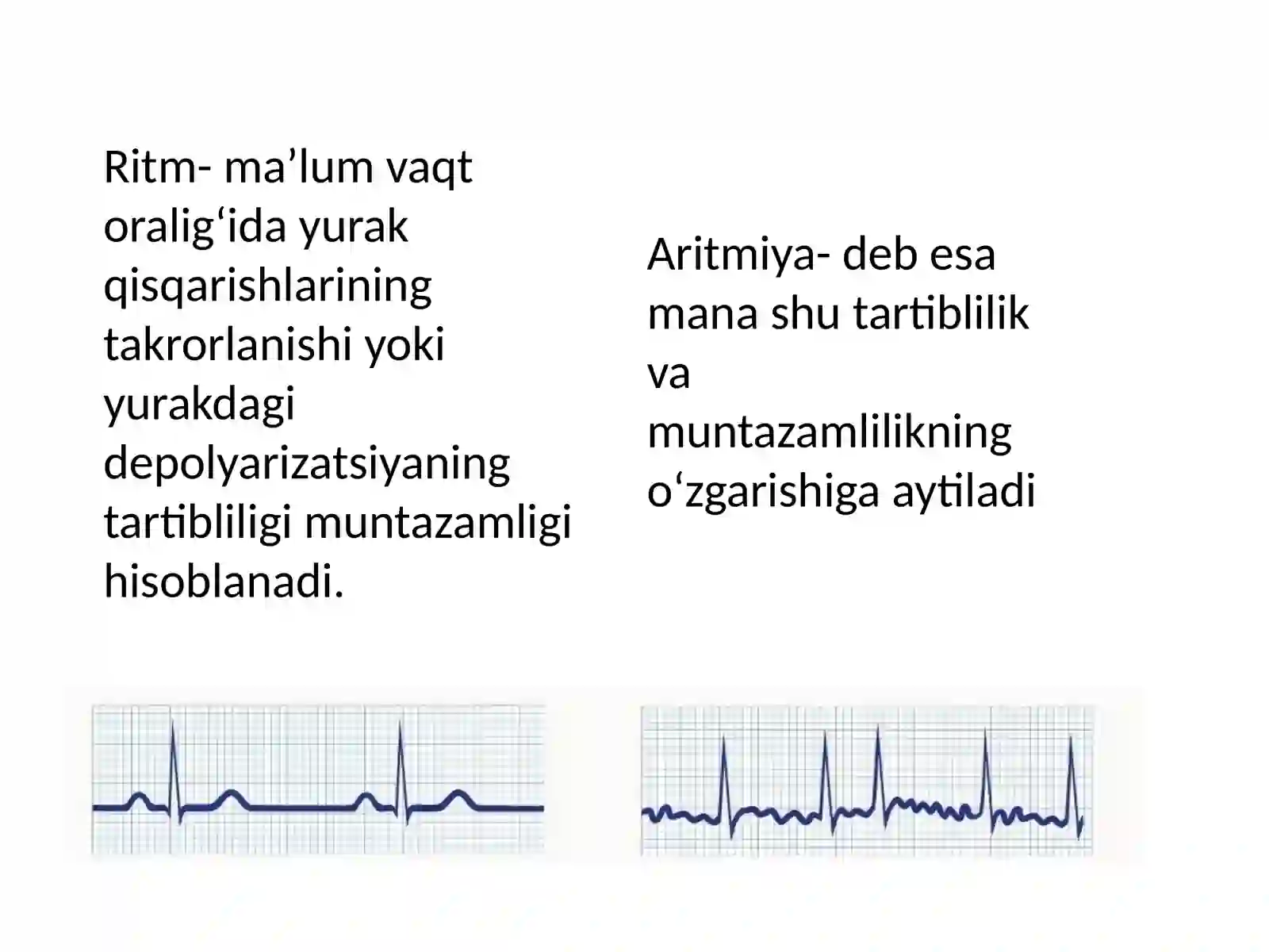Yurak ritmi buzilishlari 2
