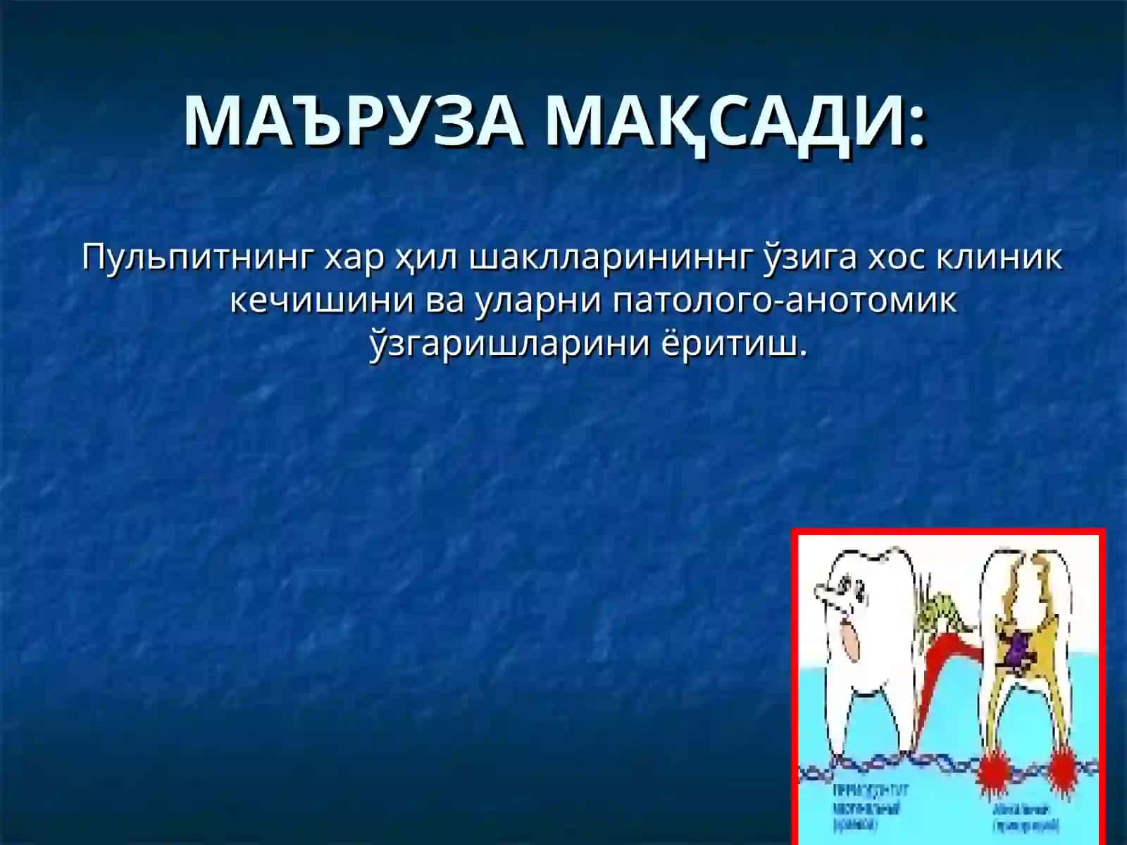 Пульпитларни клиникаси, патологик анатомияси, диагностикаси ва киёсий ташхиси 2