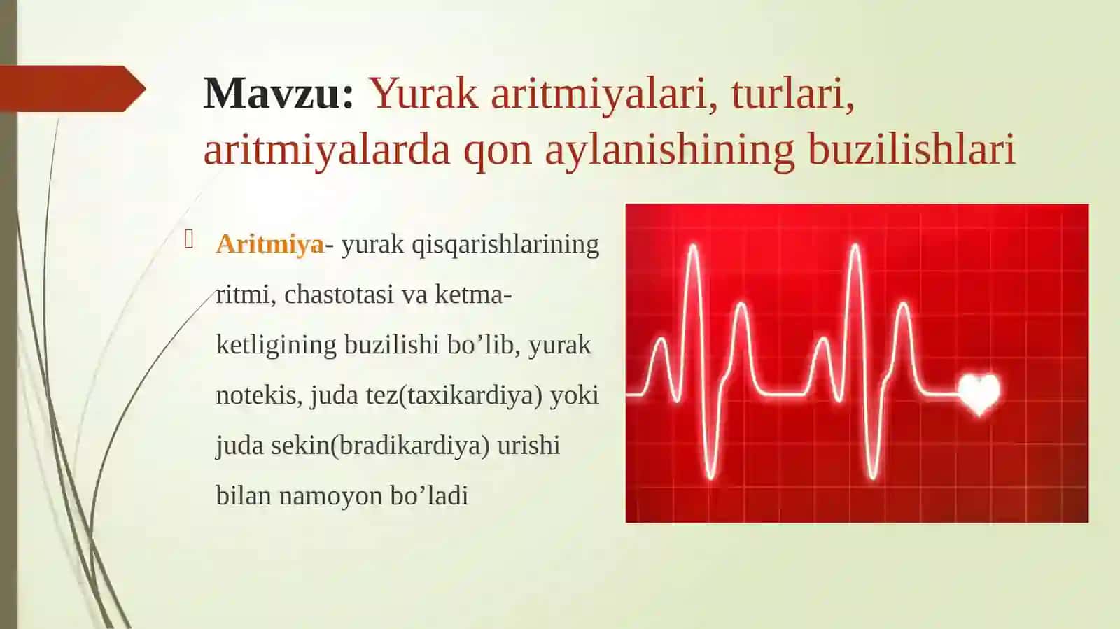 Yurak aritmiyalari va ularning asosiy shakllari 2