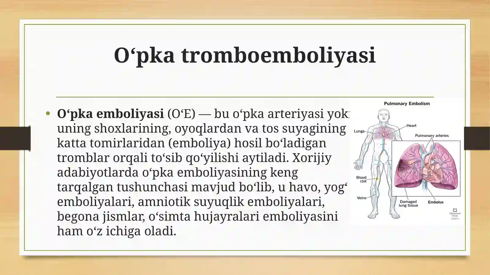 O‘pkaarteriyasitromboemboliyasi 2