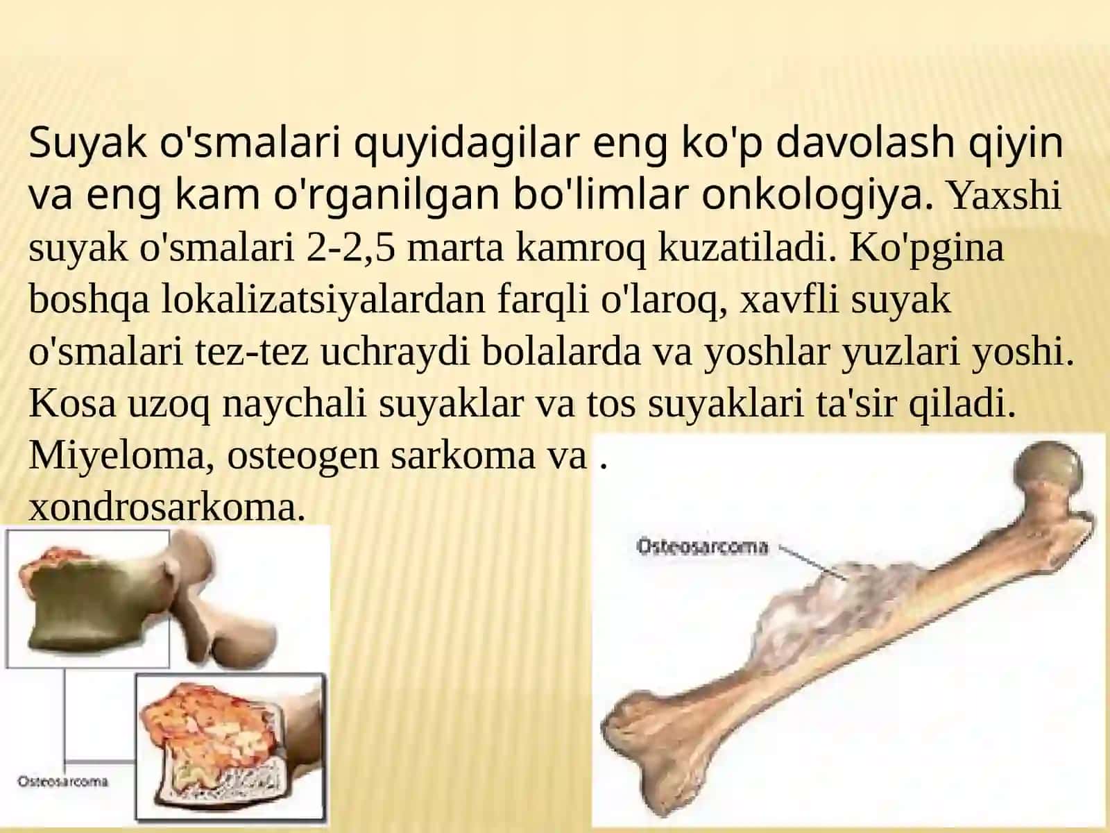 Harakat tayanch tizizmida og'riq sindromi , harakat tayanch tizimida o'sma kasalliklari 2