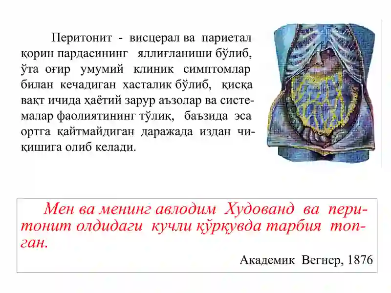 Перитонит 2