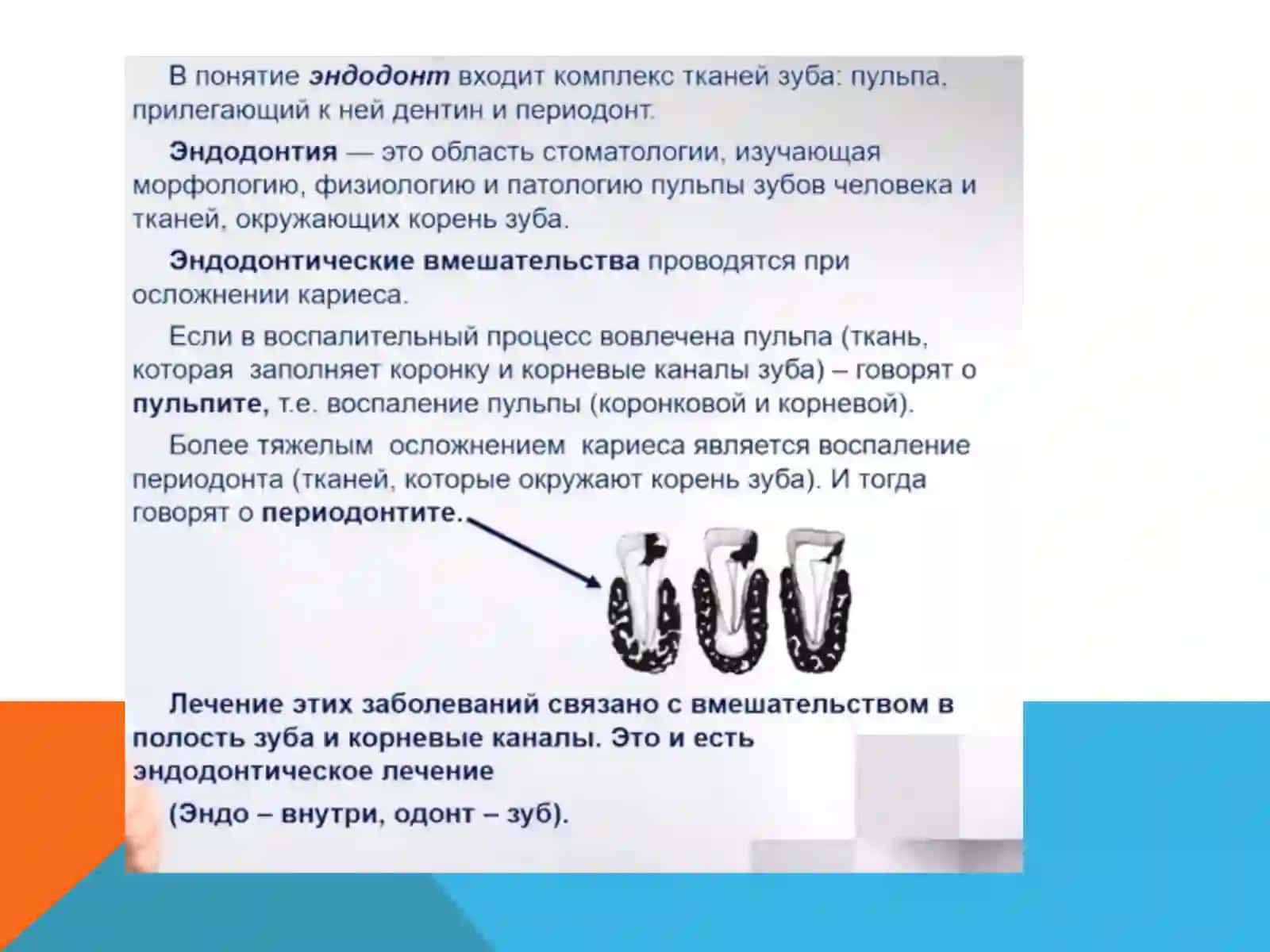 ЭНДОДОНТИЧЕСКИЙ ИНСТРУМЕНТАРИЙ 2