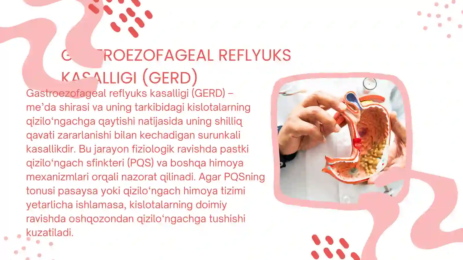 Gastroezofagal reflyuks 2