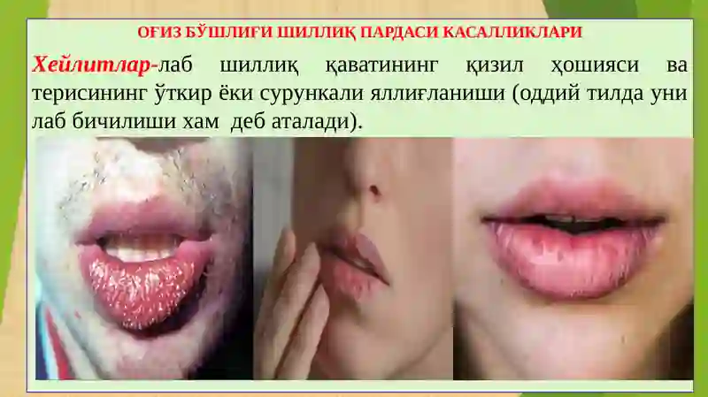 Preview 2