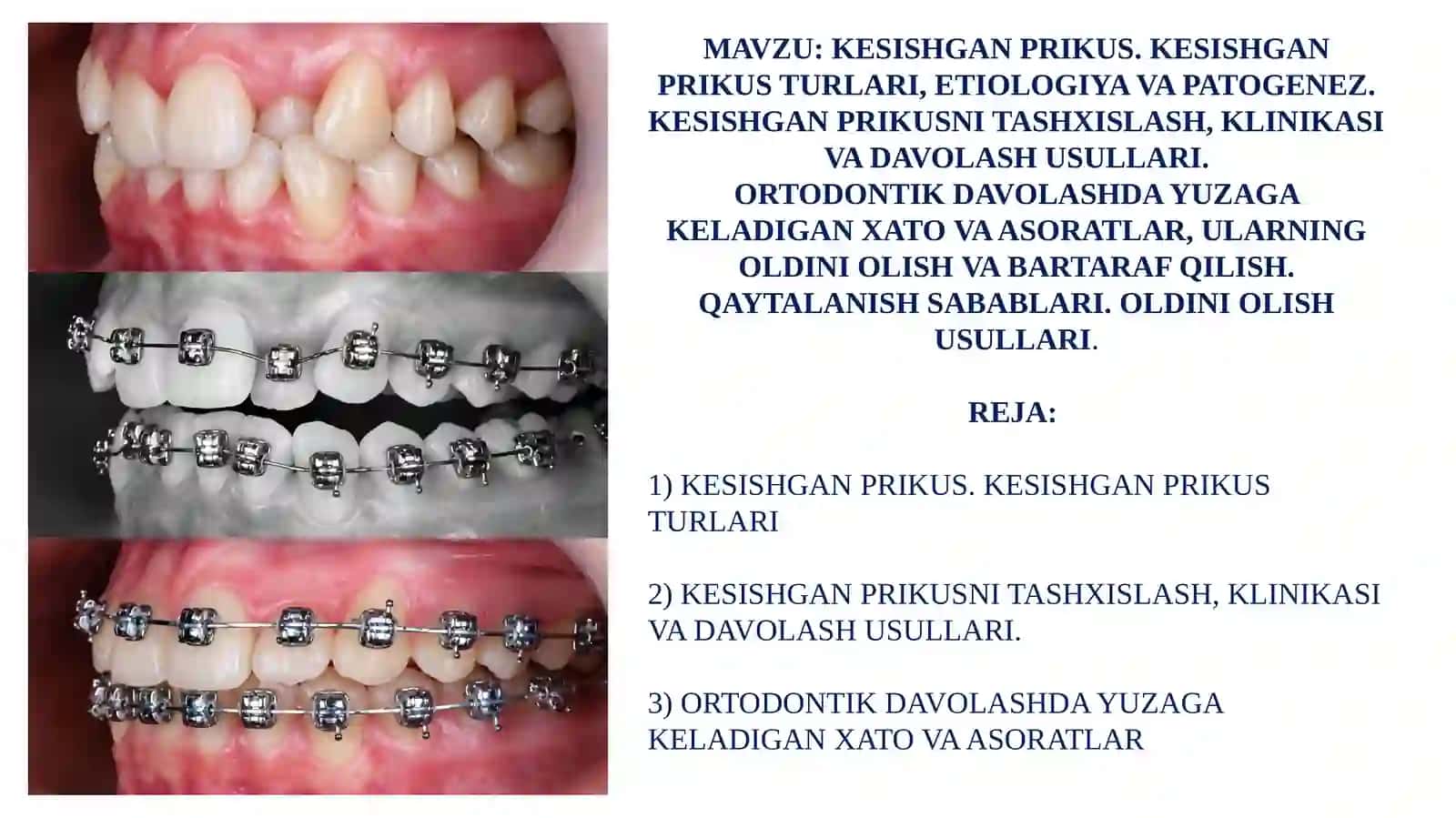 KESISHGAN PRIKUS 2