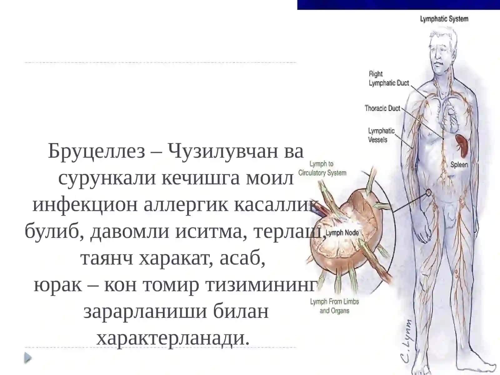 БРУЦЕЛЛЕЗ 2