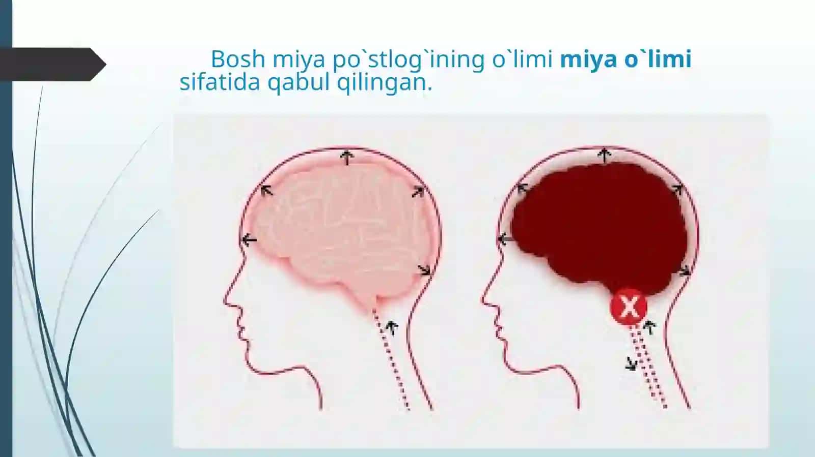 Miya o`limining diagnostikasi 2