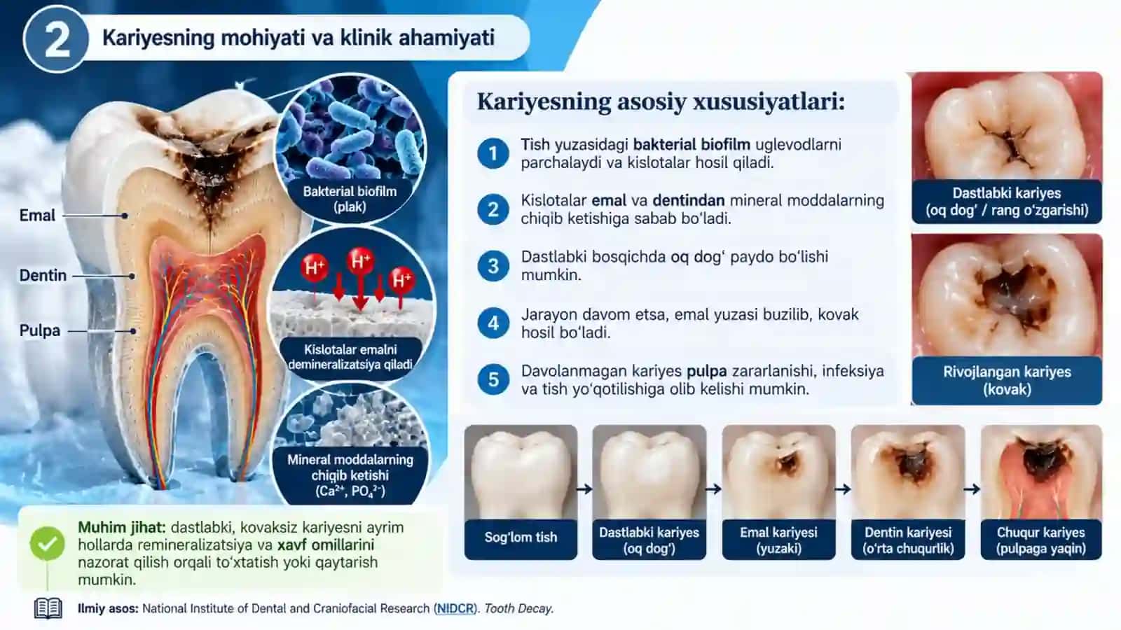 Kariyes va uning tasnifi — Professional tibbiy taqdimot 2