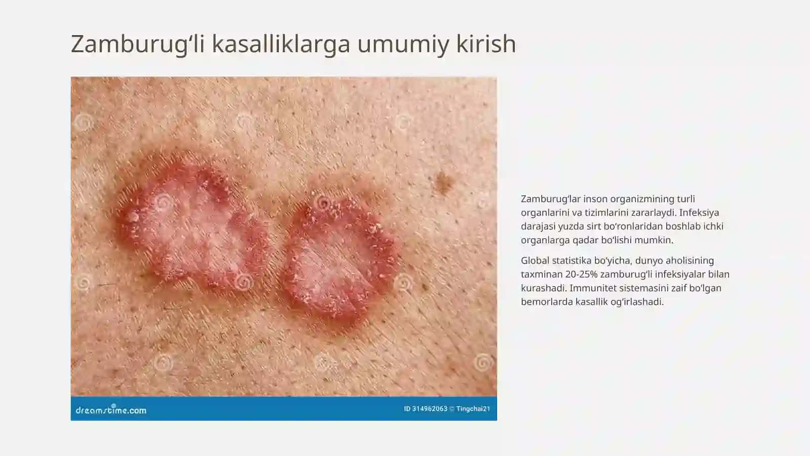 Patogen zamburugʻlar chaqiruvchi kasalliklar va ularni laboratoriya diagnostikasi 2