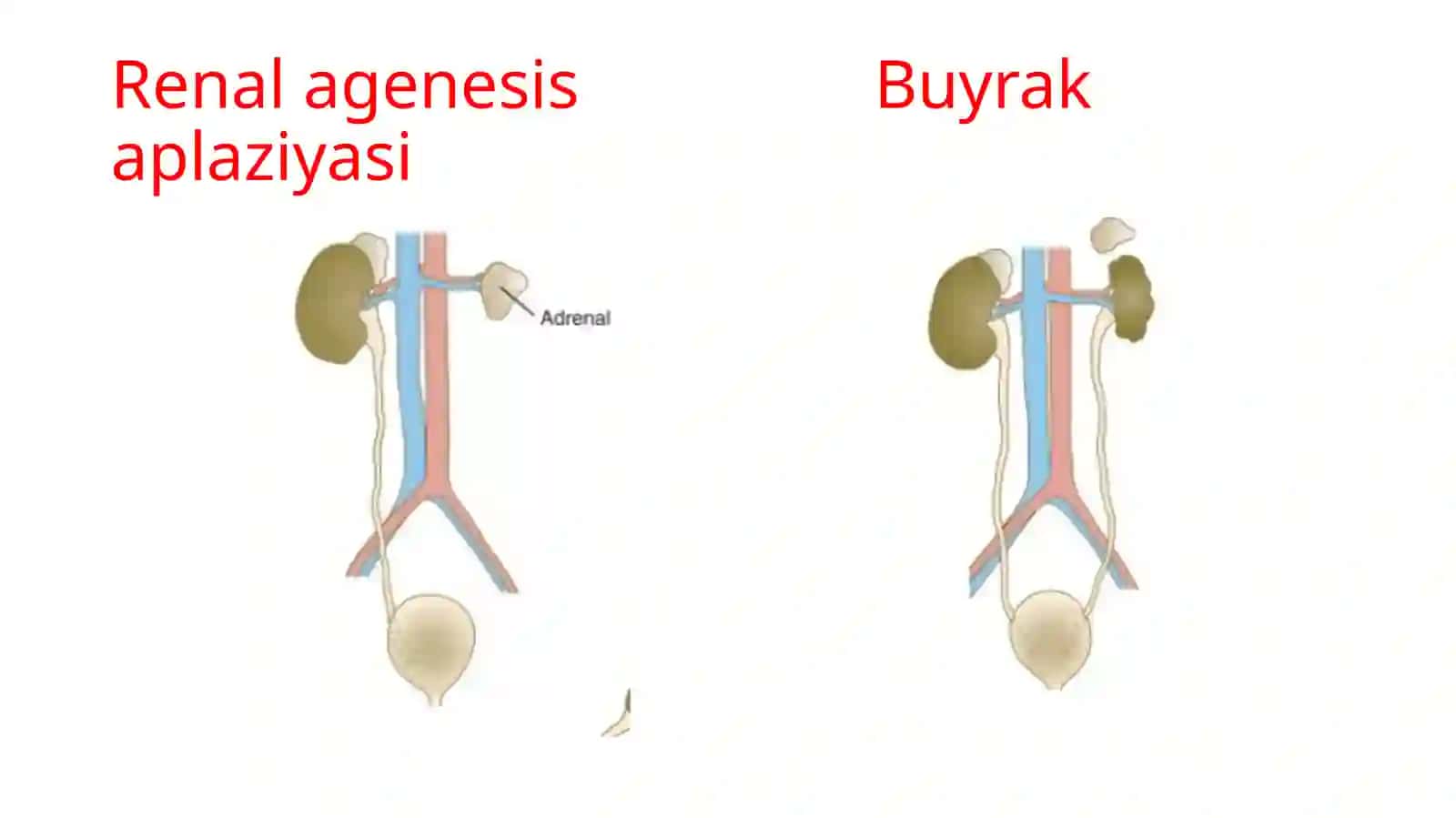 Buyrakdistopiyasi 2
