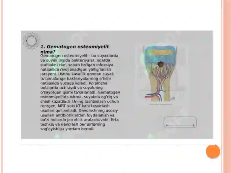 Gematogen osteomielit 2