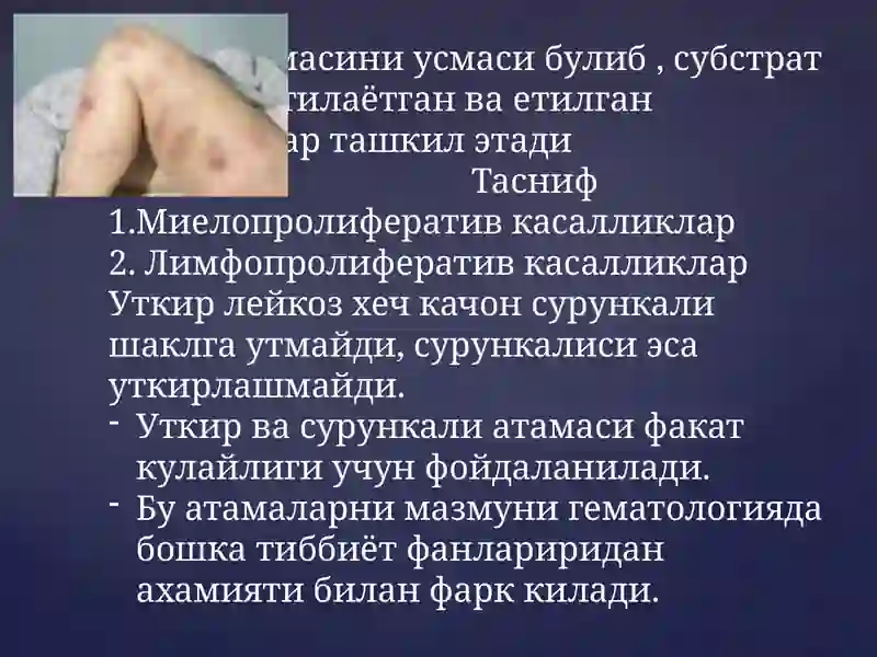 Surunkali leykozlar | Сурункали лейкозлар 2