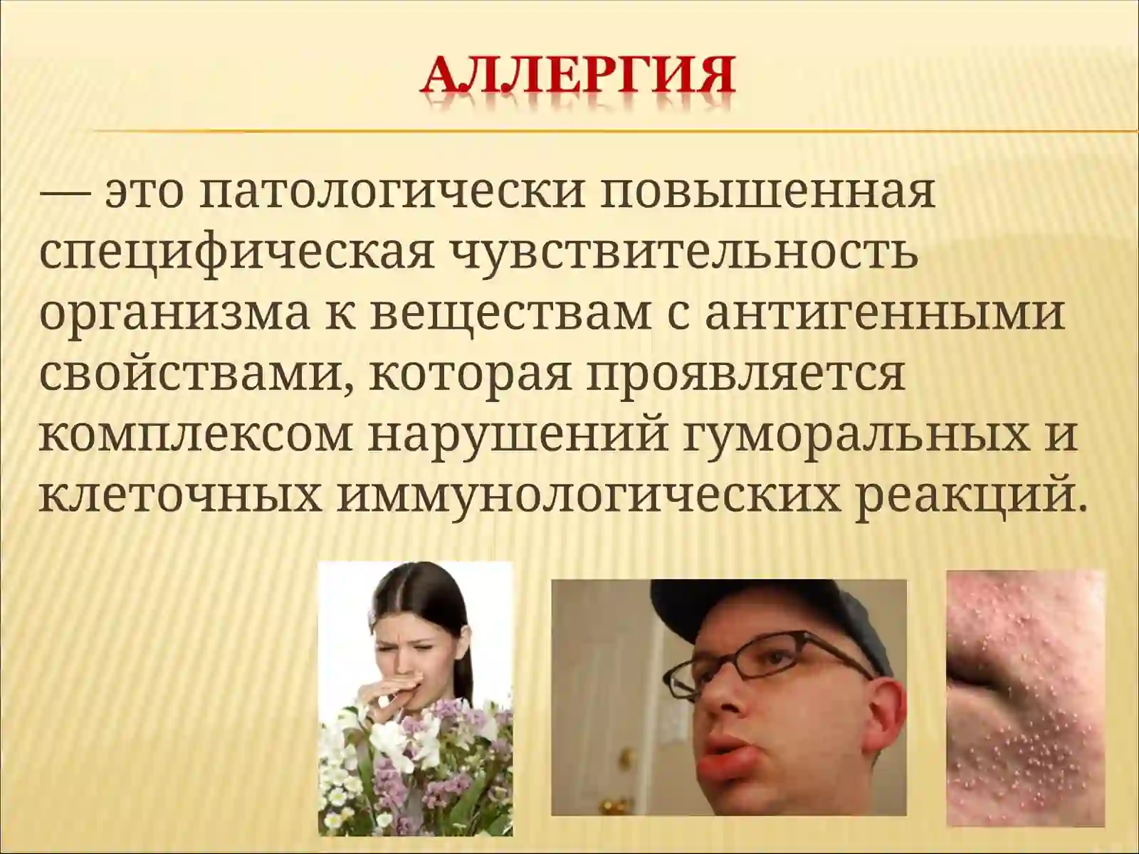 Аллергия 2