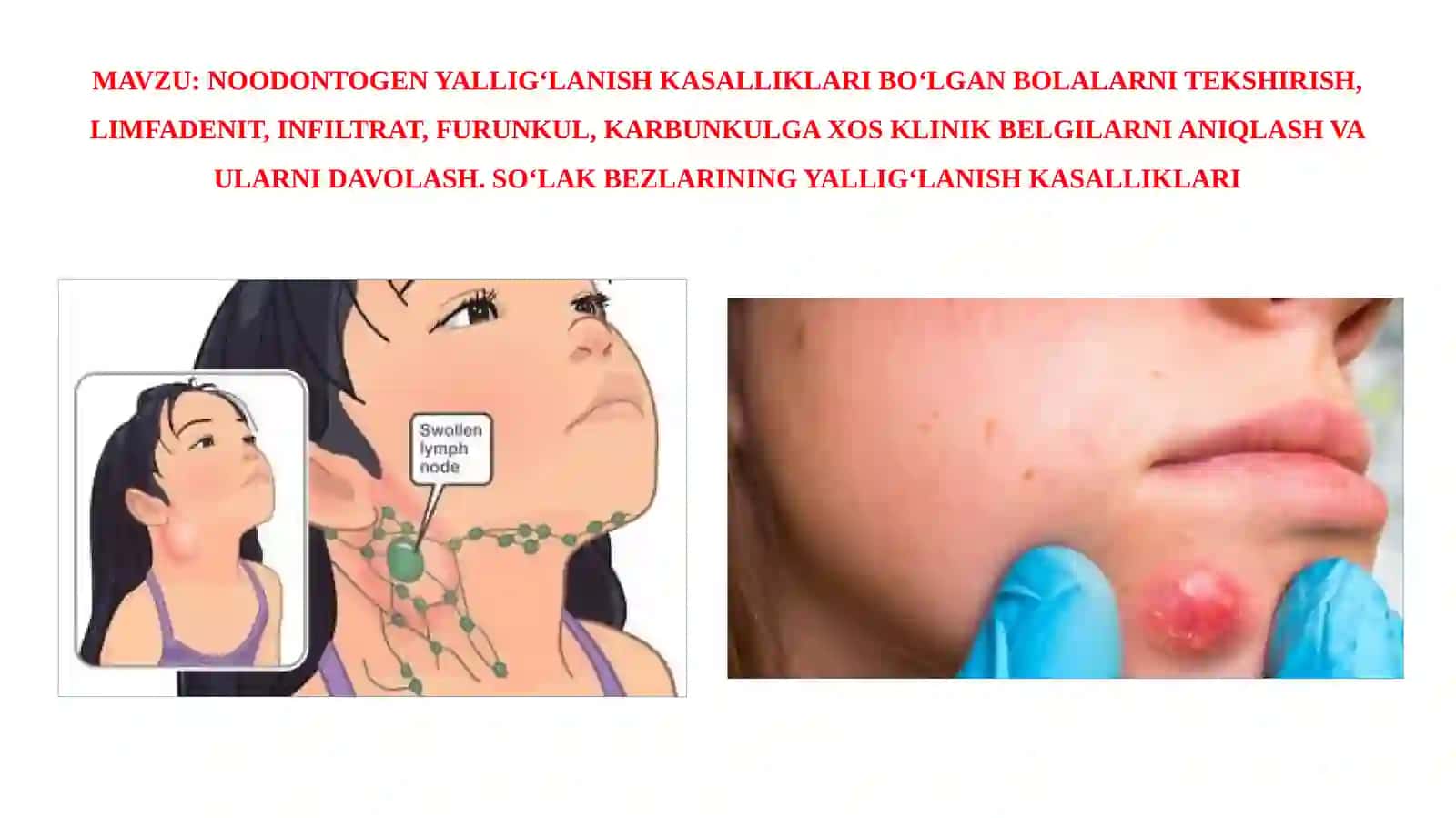 NOODONTOGEN YALLIG‘LANISH KASALLIKLARI TEKSHIRISH VA DAVOLASH 2