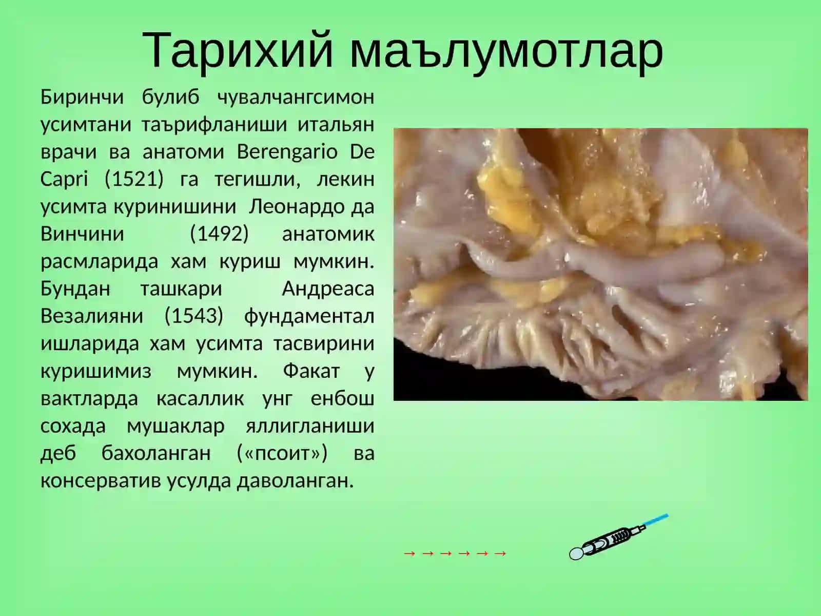 Ўткир аппендицит ва унинг асоратлари 2