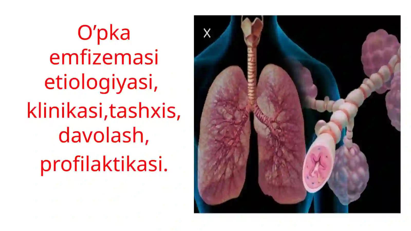 O’PKA EMFIZEMASI 2