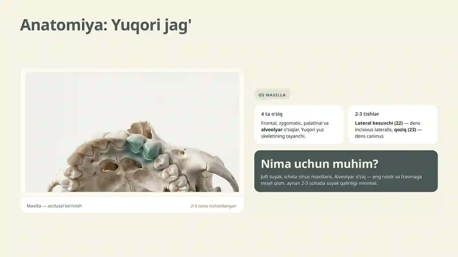 Yuqori jag’ 2-3tishlar sohasida alveolyar o’sig’ining sinishi 2