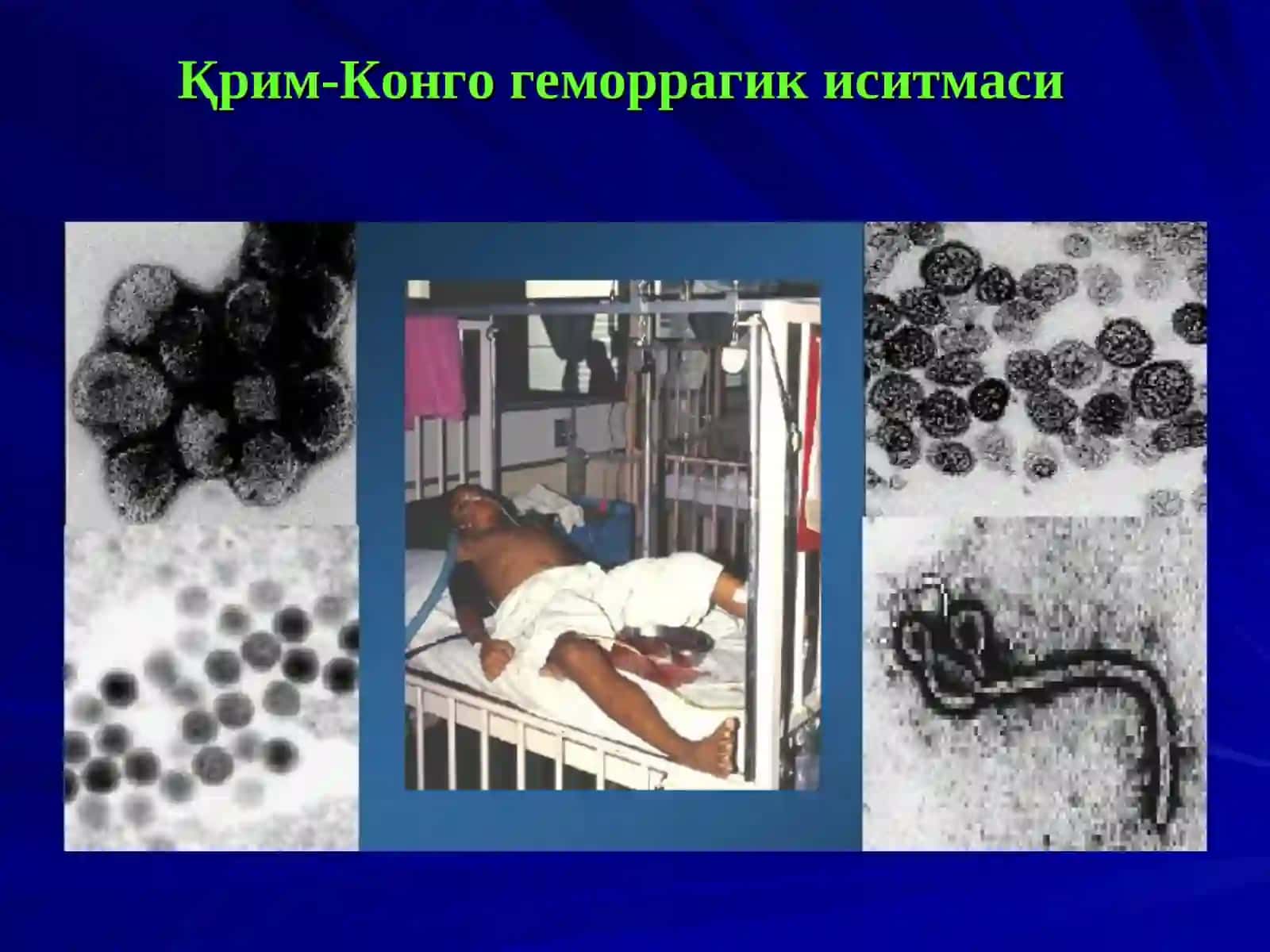 Қрим-Конго геморрагик иситмаси 2
