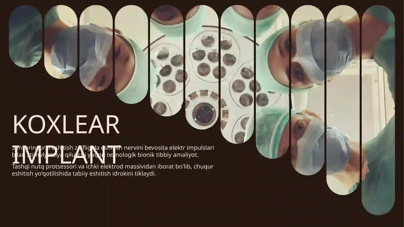 KOXLEAR IMPLANT 2