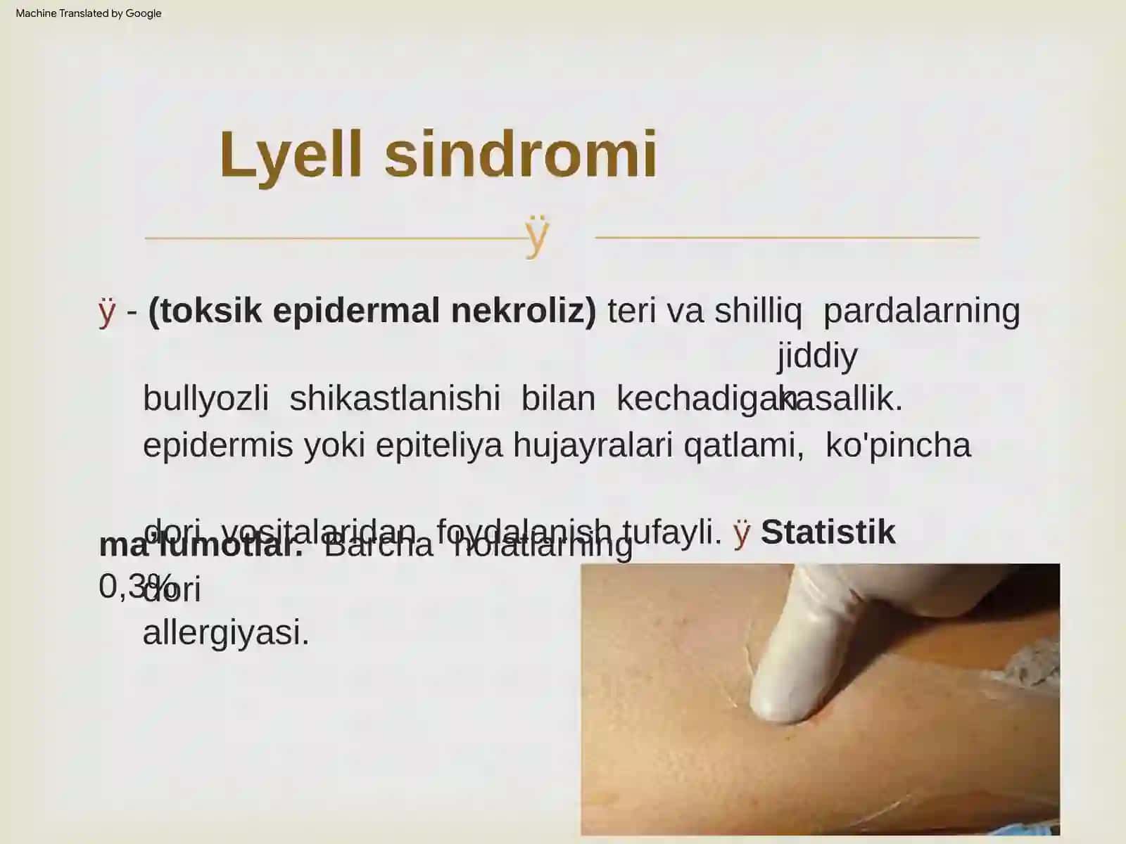 Lyell sindromi 2