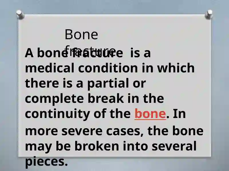 Bone fracture 2