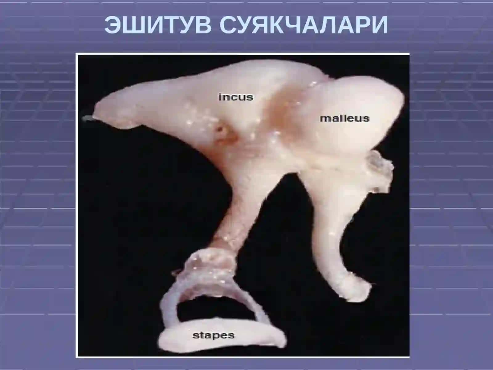 ЧИҒАНОҚ КАНАЛИ КЕСМАСИ ВА КОРТИЙА ЪЗОСИ 2