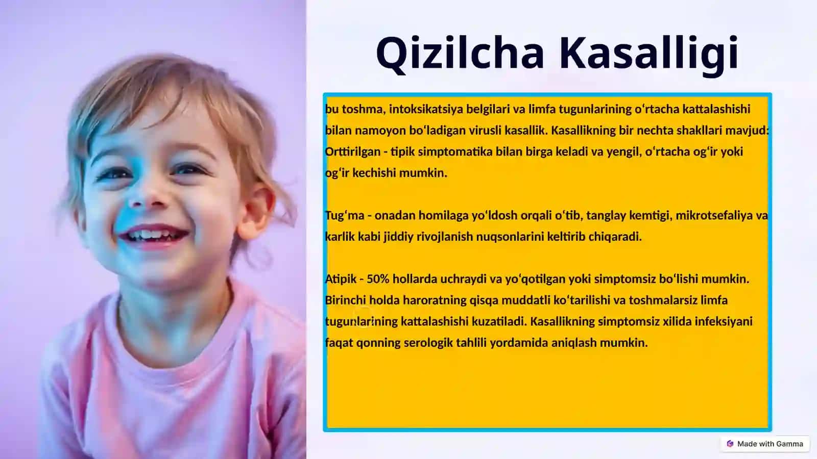 EPIDEMIOLOGIYA fanidan tayyorlagan TAQDIMOTI. Qizilcha Kasalligi 2