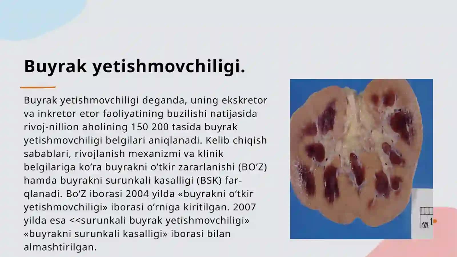 O’tkir buyrak yetishmovchiligi 2