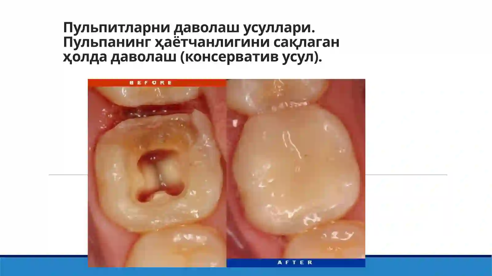 vital amputatsiya 2