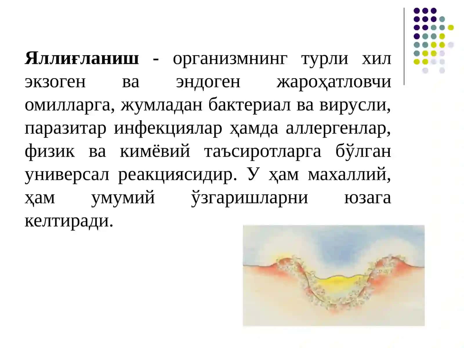 Яллиғланишга қарши дори 2