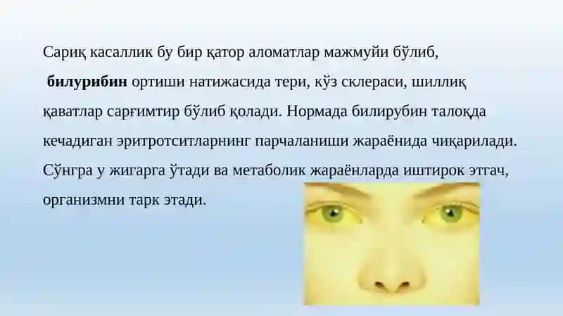 Сариклик синдроми билан кечадиган юкумли ва юкумли булмаган касалликларни эрта ва киёсий ташхиси 2