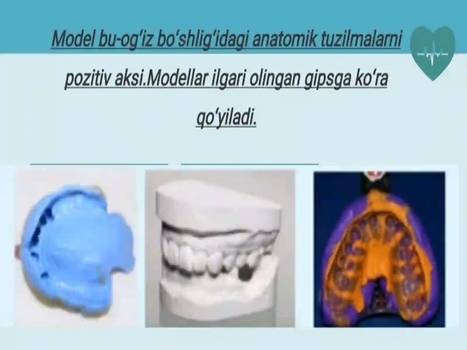 Stomatologiyada modellarni tayyorlash. Gipsli modellar 2