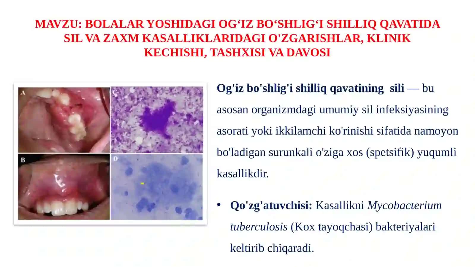 BOLALAR YOSHIDAGI OG‘IZ BO‘SHLIG‘I SHILLIQ QAVATIDA SIL VA ZAXM KASALLIKLARIDAGI O'ZGARISHLAR, KLINIK KECHISHI, TASHXISI VA DAVOSI 2