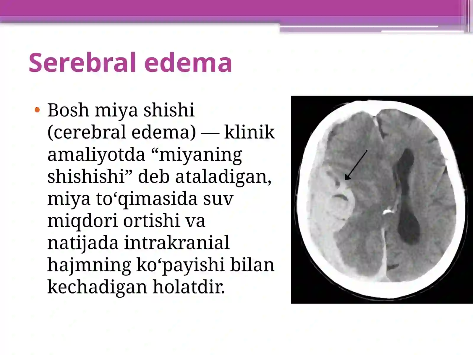 Bosh miya shishi 2
