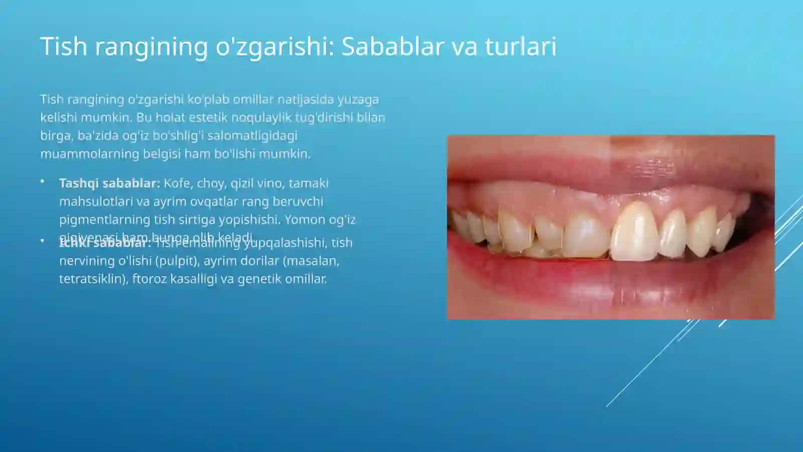 TISHLARNING RANG, SON VA SHAKL O'ZGARISH HOLATLARI 2