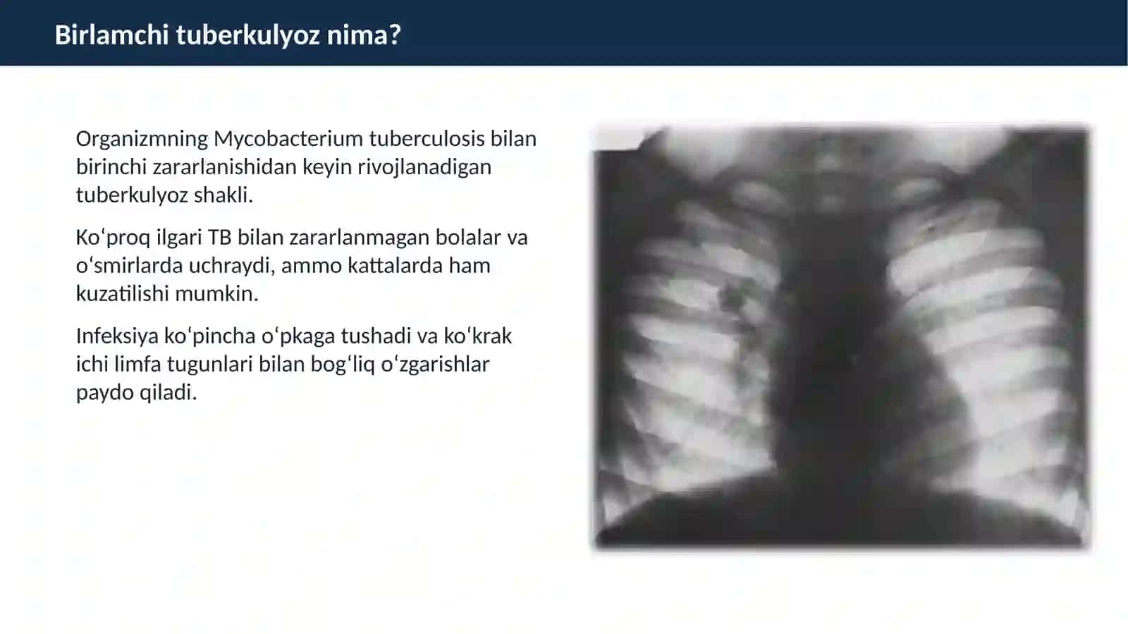 BIRLAMCHI TUBERKULYOZ 2