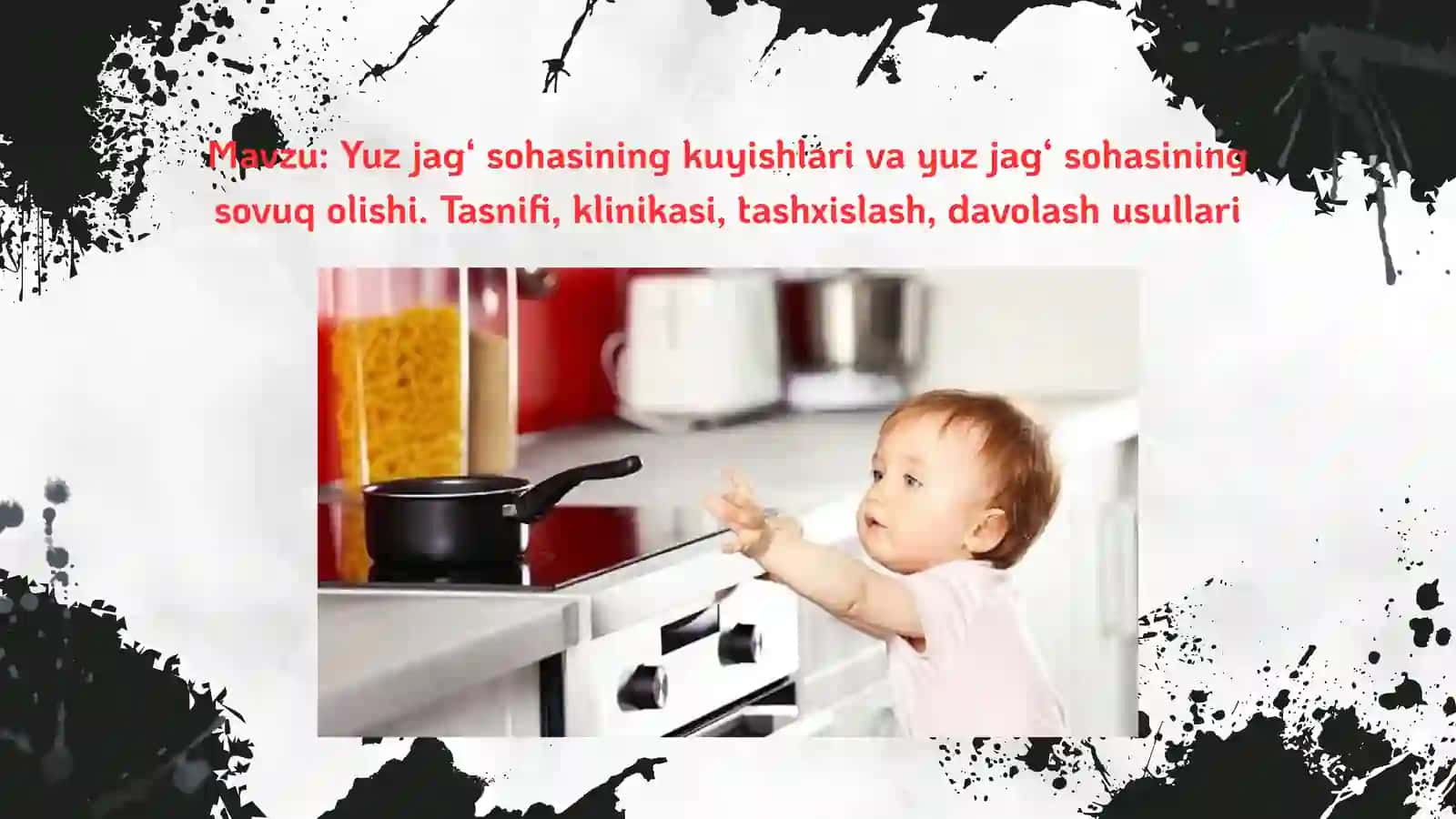 Yuz-jagʻ sohasi kuyishlari va sovuq olishi 2