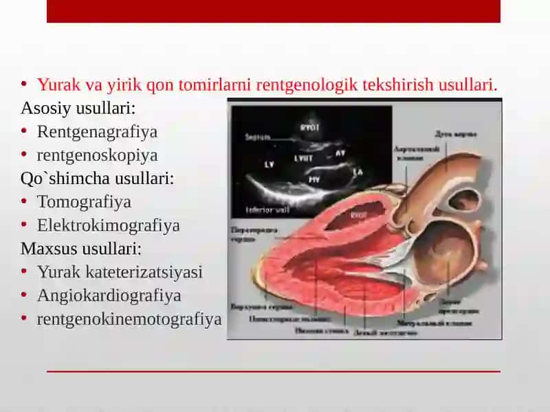 Yurak va yirik qon tomirlar kasalliklarining kompleks nur diagnostikasi 2