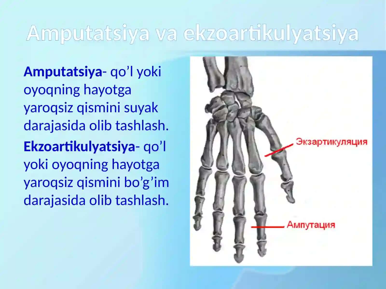 Amputatsiya, protezlashishlar va nogironlar reabilitatsiyasi 2