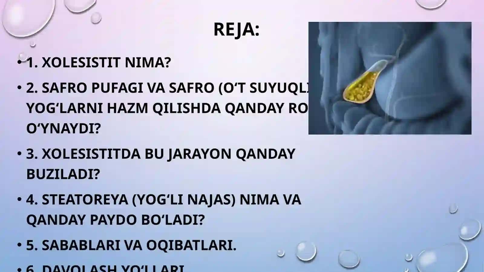xolesistit 2