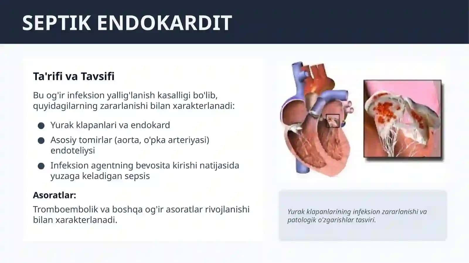 SЕPTIK ENDOKARDIT. AORTAL NUKSONLAR SIMPTOMATOLOGIYASI. AORTAL KLAPAN YETISHMOVCHILIGI. DIAGNOSTIKA. DAVOLASH PRINSIPLARI 2