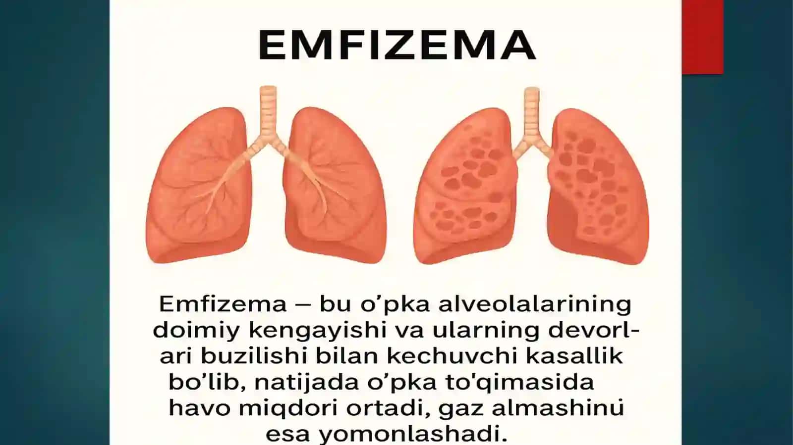 Etiologiyasi(sabablari) 2