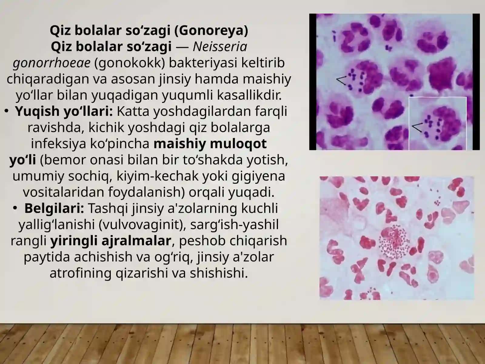 Qiz bolalar so‘zagi. Gonoblenoreya va uning profilaktikasi, gonokokkli proktit. Bakterial vagino 2