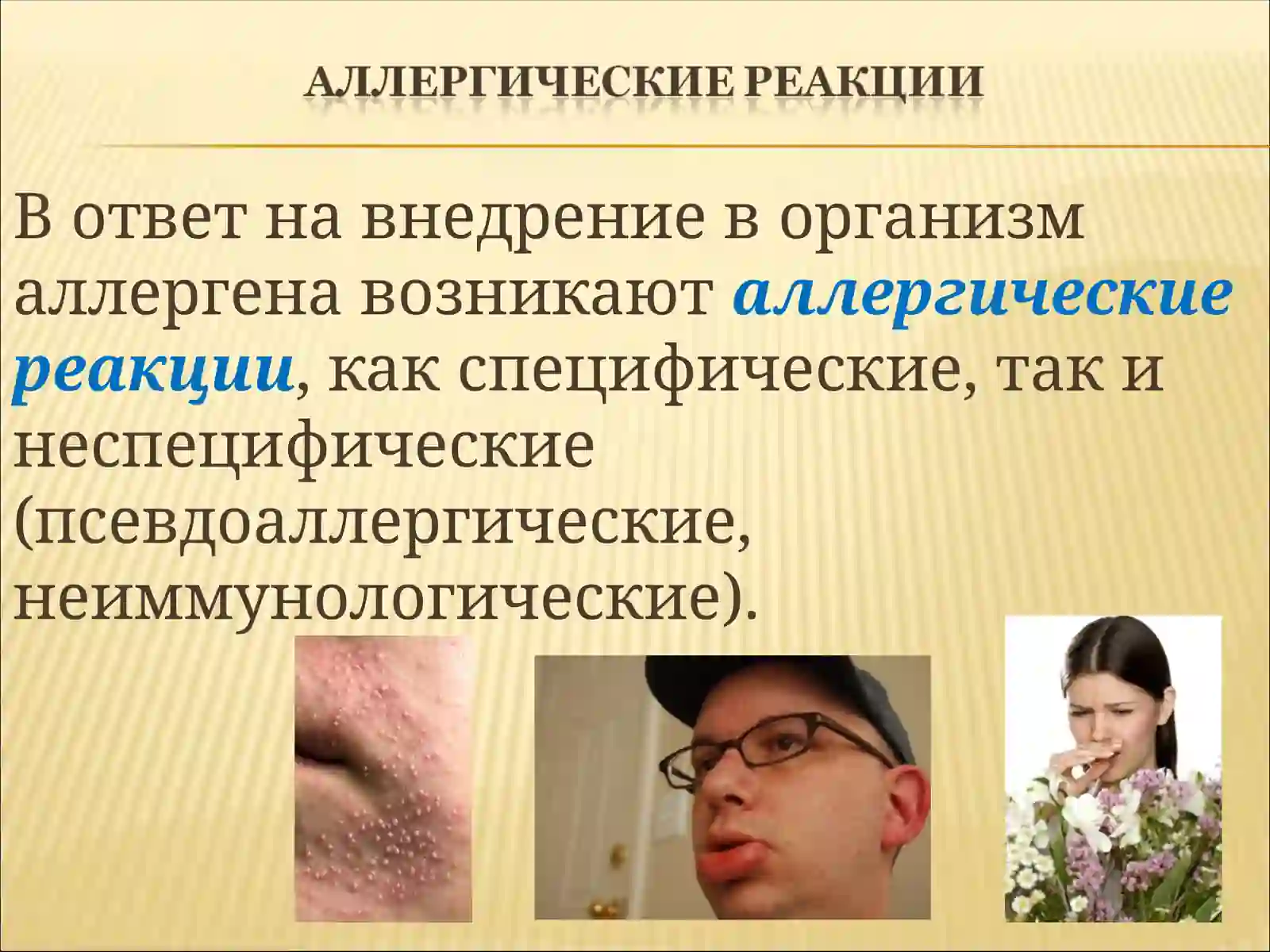 Аллергия 2