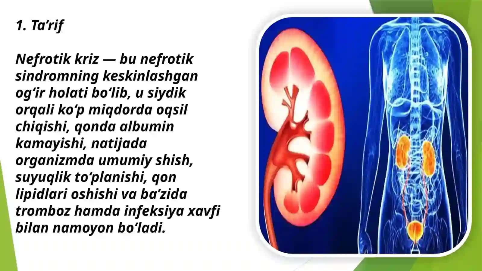 O’tkir buyrak yetishmovchiligi. Nefrotik kriz 2