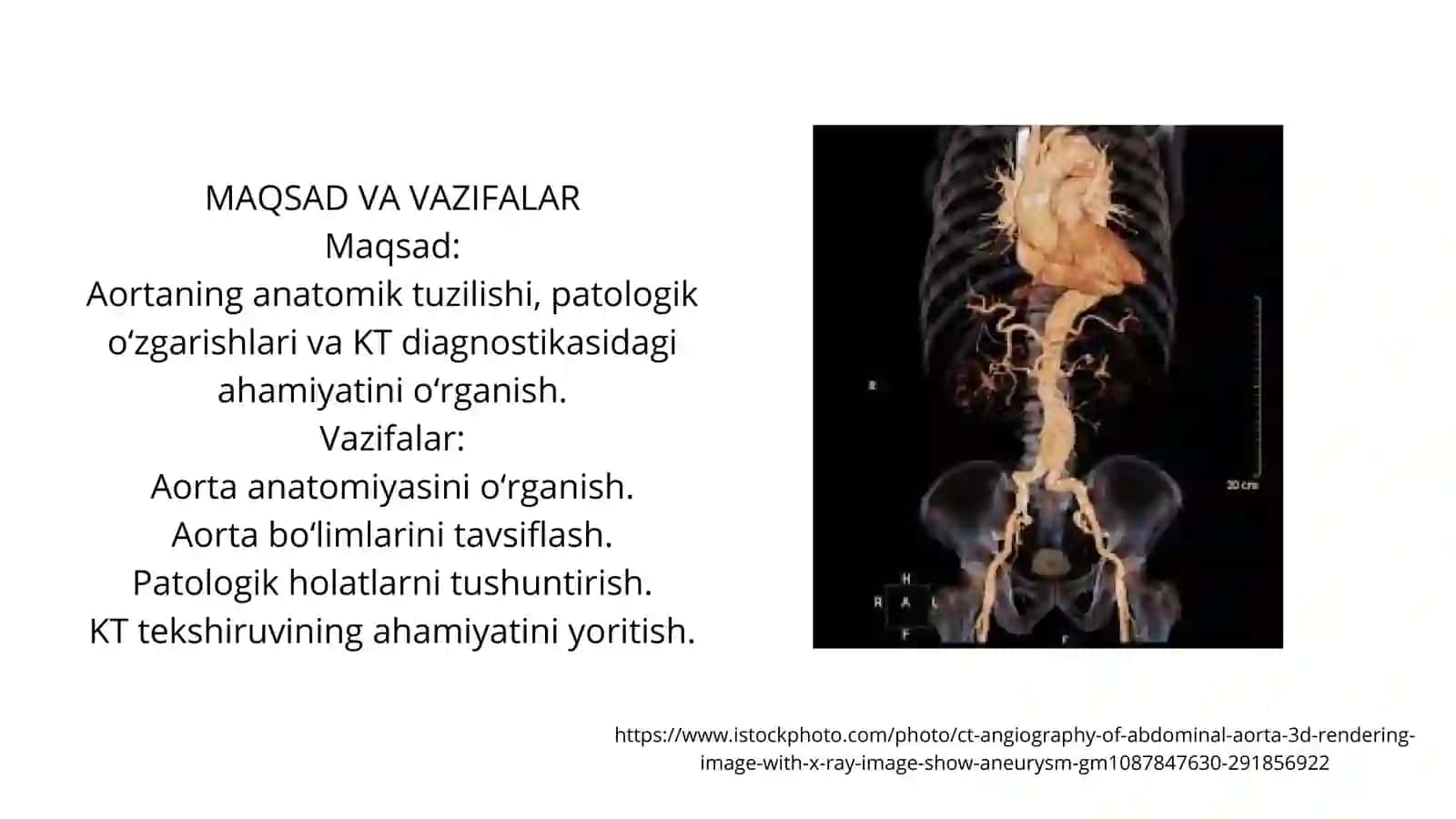 Aortaning patomorfologik-anatomik korrelyatsiyasi Aorta va  ichida klinik keys bor 2